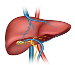 Liver Transplant