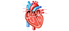Congenital Heart Defect Surgery