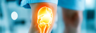 Knee Replacement